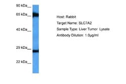 SLC7A2 Rabbit anti-Human, Polyclonal, Novus Biologicals 0.1 mL | Buy Online | Novus Biologicals | Fisher Scientific